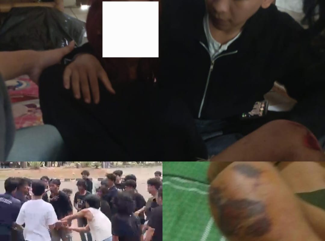 Mahasiswa FP Unila Diduga Dikeroyok Usai Kericuhan Parade, Keluarga Desak Polisi Usut Pelaku